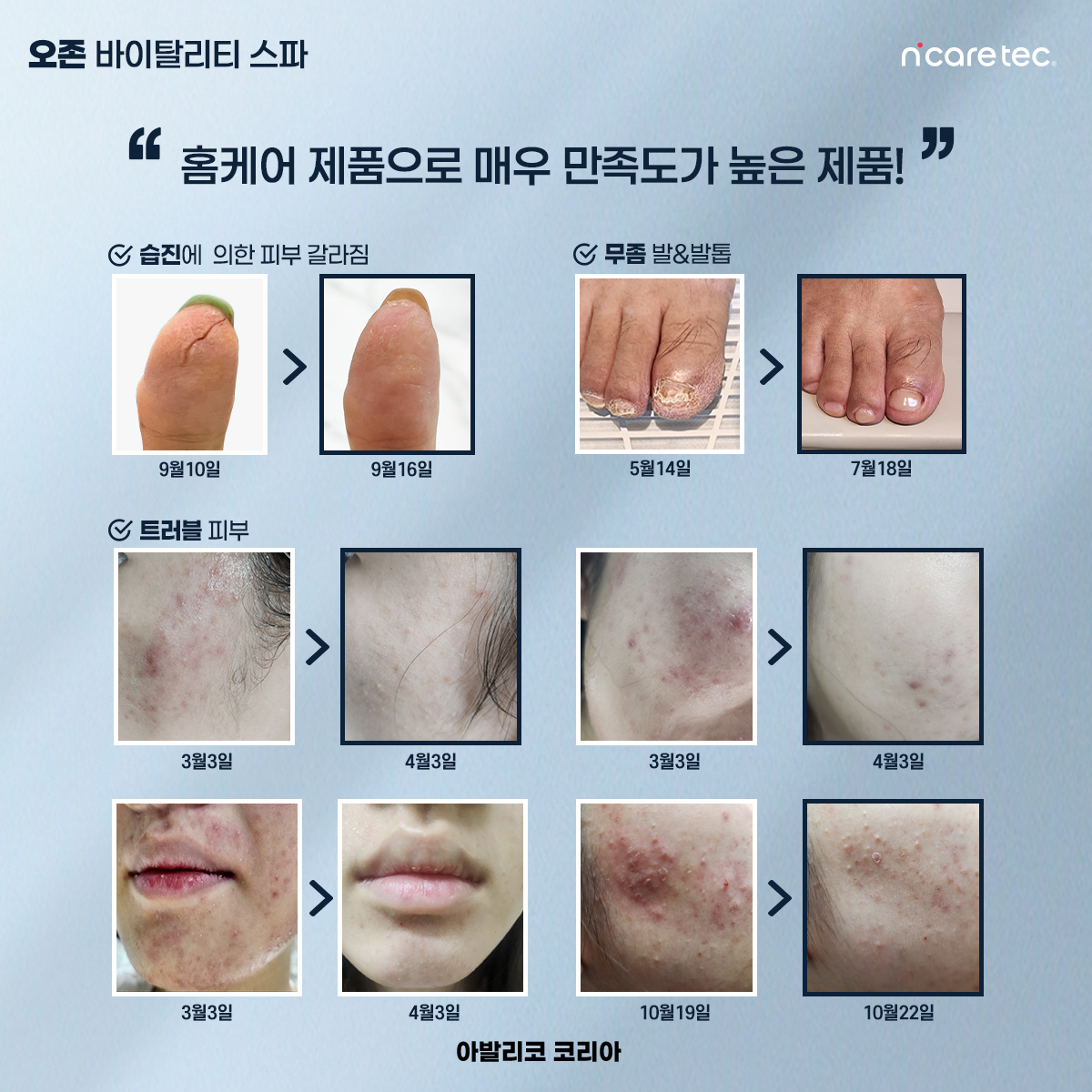 인스타-오존스파07.jpg